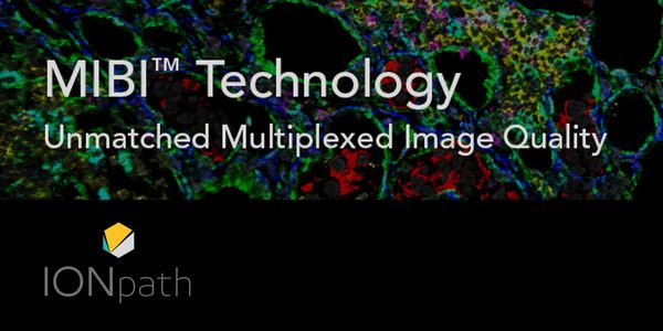 Comprehensive Enumeration of Immune Cells in Solid Tumors