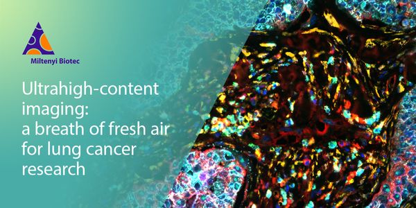 Ultrahigh-content imaging: a breath of fresh air for lung cancer research