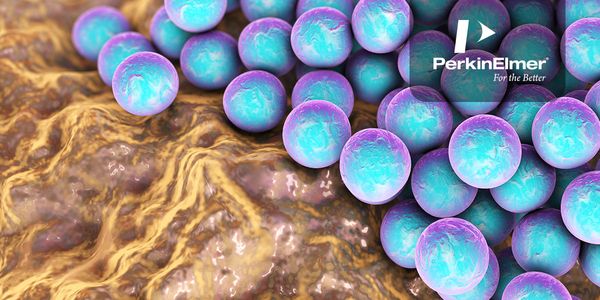 Combating AMR in Bacterial Infections and Investigating the Immune Response