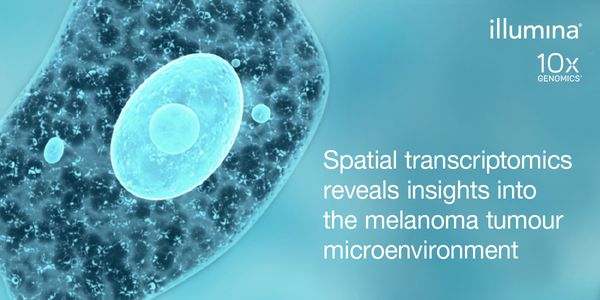 Spatial transcriptomics reveals insights into the melanoma tumour microenvironment