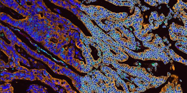 Elevate Your Research with Spatial Insights