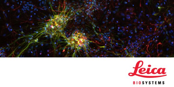 Multiplex Immunofluorescence Profiling of Tumor Biopsies Using UltraPlex mxIF Technology
