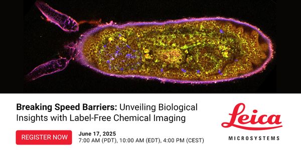 Breaking Speed Barriers: Unveiling Biological Insights with Label-Free Chemical Imaging