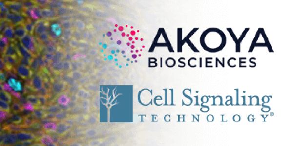 Multiplexing on Mouse tissue using Cell Signaling Technology antibodies and OPAL IHC method