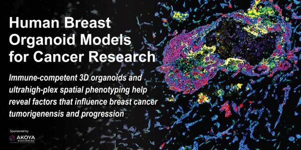 Human Breast Organoid Models for Cancer Research