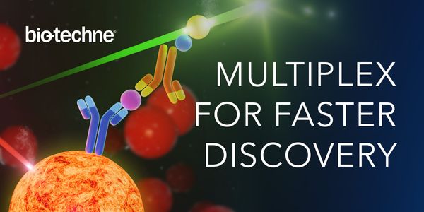 Optimizing Cytokine Analysis-Choosing the Right Assay for Accurate Detection and Interpretation of Cytokine Expression
