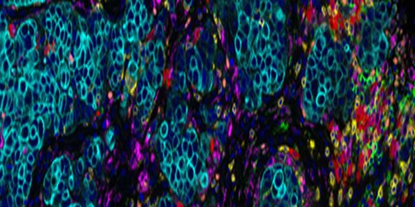 Tissue Biomarker Analysis: A Practical Approach for Translational Research