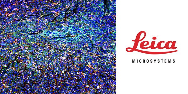 Unveiling Tumor Immune Landscape: Using Multiplexed Whole-Tissue Imaging and AI-Powered Spatial Analysis