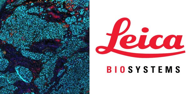 Multiplex fluorescence immunohistochemistry using the Ultivue InSituPlex platform on the Leica Biosystems BOND RX