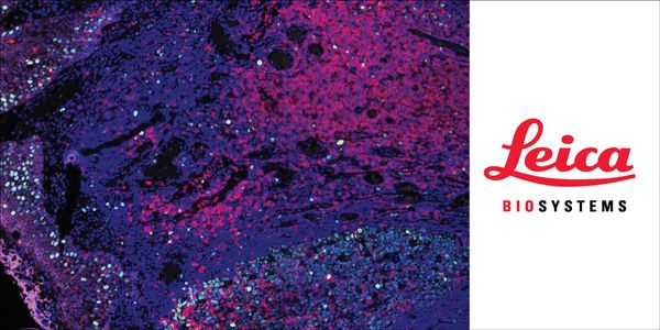 Validating antibodies for research applications in IHC