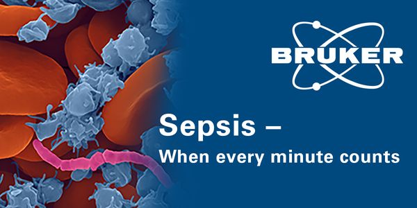 Impacting Patient Outcomes With Rapid Positive Blood Culture ID Utilizing MALDI Mass Spectrometry