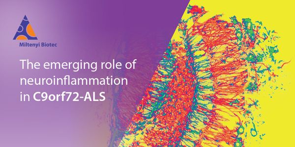 Emerging role of neuroinflammation in C9orf72-ALS
