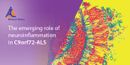 Emerging role of neuroinflammation in C9orf72-ALS
