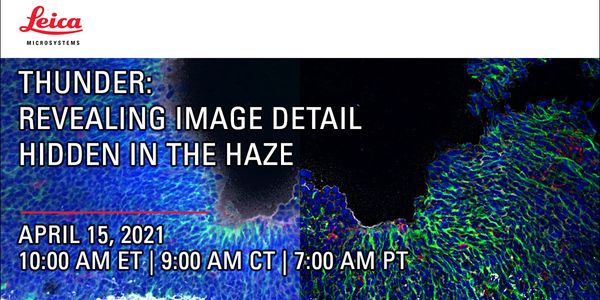 THUNDER - Revealing Image Detail Hidden in the Haze