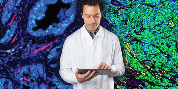 Fully Automated Workflows for High Plex Multi-omic Profiling with GeoMx® Digital Spatial Profiler and BOND RX/ BOND RXm Research Stainer