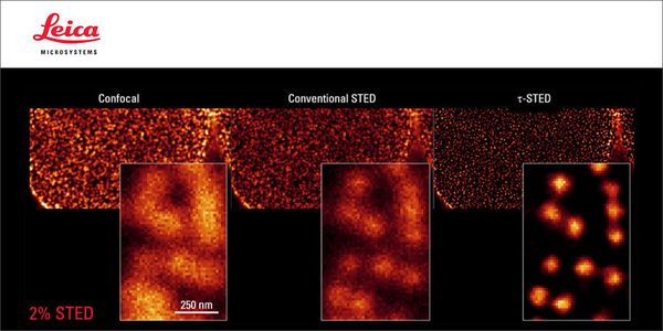 Nanoscopy Meets Lifetime - Introducing the new STELLARIS 8 τ-STED