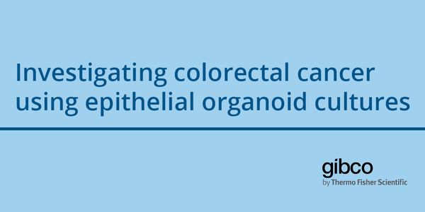Investigating colorectal cancer using epithelial organoid cultures
