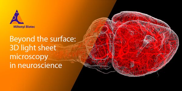 Beyond the surface of neuroscience: 3D imaging of large biological samples with light sheet microscopy