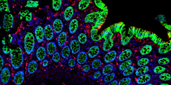 Tissue preparations and handling for multiplex imaging in spatial biology research