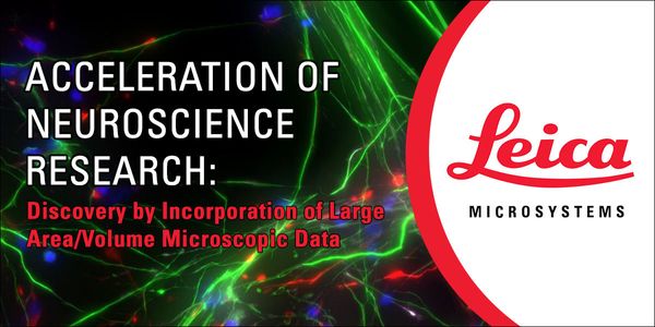 Acceleration of Neuroscience Research Discovery by Incorporation of Large Area/Volume Microscopic Data