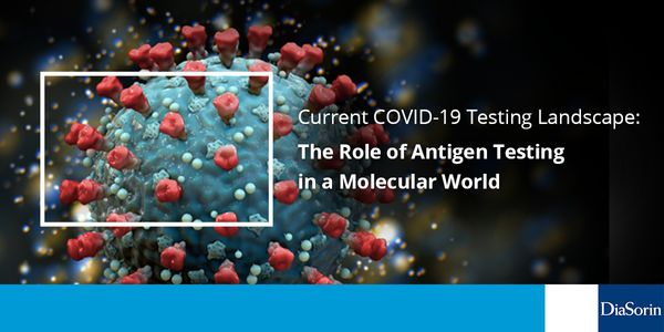 Current COVID-19 Testing Landscape: The Role of Antigen Testing in a Molecular World