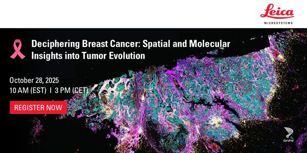 Deciphering Breast Cancer: Spatial and Molecular Insights into Tumor Evolution