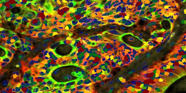 Accelerating Microscopy Image Analysis with AI