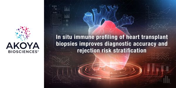 In situ immune profiling of heart transplant biopsies improves diagnostic accuracy and rejection risk stratification