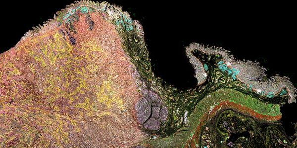 Cell DIVE: Transforming tissue research with open multiplexing