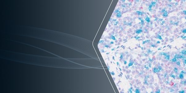 Combining RNAscope™ Technology with Protein Detection: A Multi Omics approach using RNA-Protein Integrated Co-Detection Workflow (ICW)