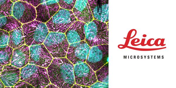 Epithelium Formation: Cellular Adhesion Regulation in 3D