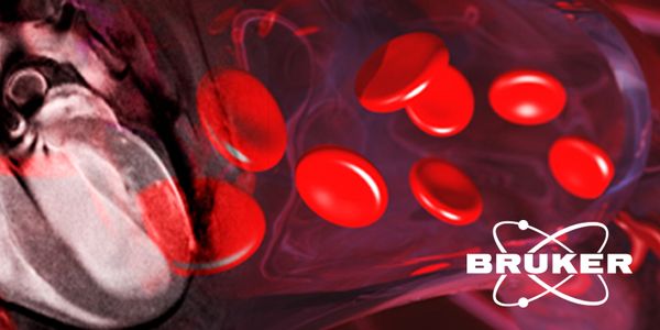 Cardiovascular Disease: Applying MRI to study atherosclerosis, the aortic arch and endothelial permeability in small animal models