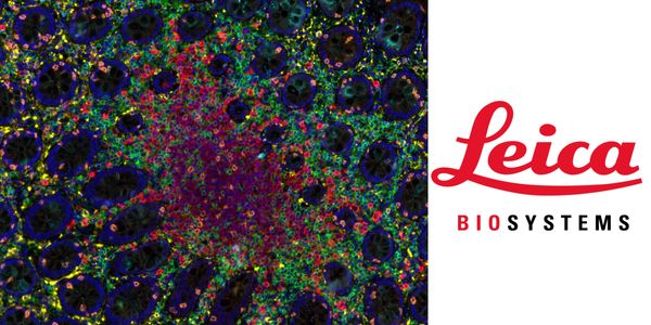 Exploiting digital histology approaches to probe the pathophysiology of SARS-CoV-2 infection