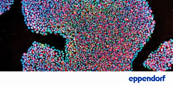Stem cell culture: Make or break - Find the optimum for your MSCs and PSCs