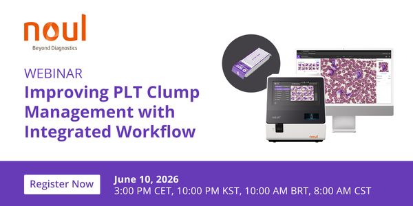 Transformative Workflow: Mastering Integrated Decision-Making for Greater Confidence in PLT Clump Management