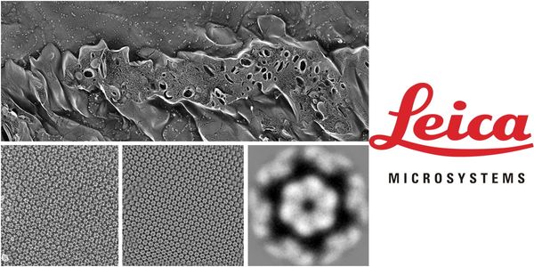 Advancing Cellular Ultrastructure Research with Freeze-Fracture and Freeze-Etching