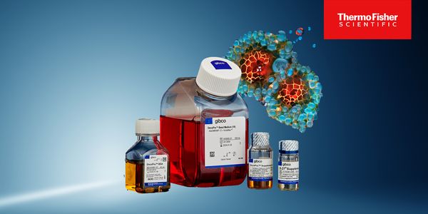 Advancing cancer organoid drug screening with novel media systems