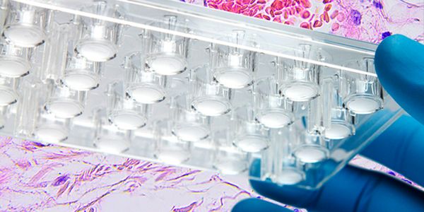 Visualizing Cancer Biology through Cell Culture Inserts