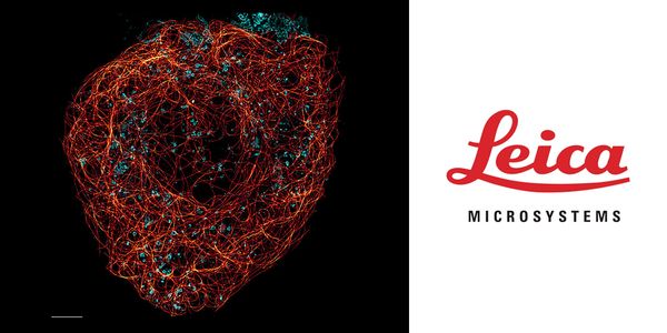 Insights into Structure, Dynamics, and Function of Endocytic Vesicles on the STELLARIS Confocal Platform