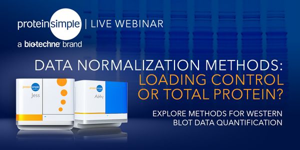 Tubulin or Not Tubulin? Heading towards total protein staining as a loading control in immunological protein analytical methods