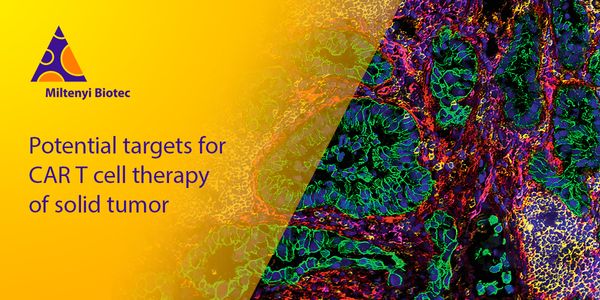 Early identification of target candidates for pancreatic adenocarcinoma immunotherapy