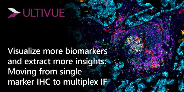 Visualize more biomarkers and extract more insights: Moving from single marker IHC to multiplex IF