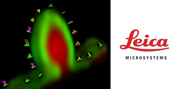 Visualizing membrane transformation in Live Cell with STED: Fusion and Budding