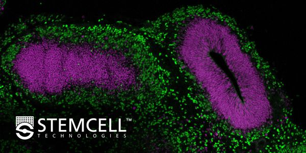 Modeling the human brain using induced pluripotent stem cells (iPSCs)