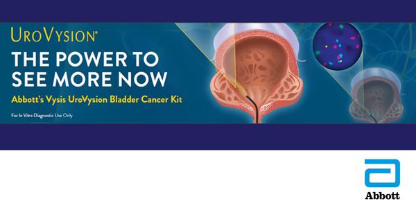 Predicting Response to Intravesical Immunotherapy with BCG