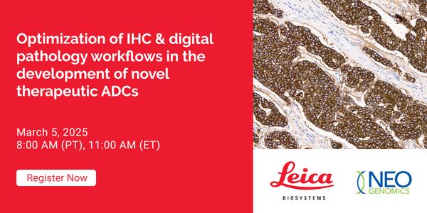 Optimization of IHC & digital pathology workflows in the development of novel therapeutic ADCs