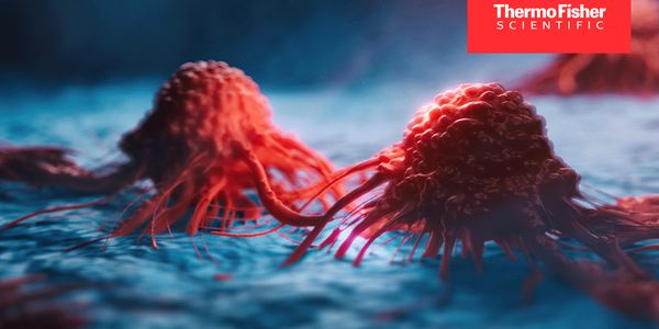 Applications in Cancer Research: RNA Isolation from Organoids and Spheroids