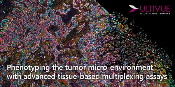 Phenotyping the tumor micro-environment with advanced tissue-based multiplexing assays