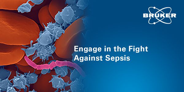 Performance comparison of Bruker MBT Sepsityper® Kit US IVD for culture-independent identification and antimicrobial susceptibility testing from positive blood cultures