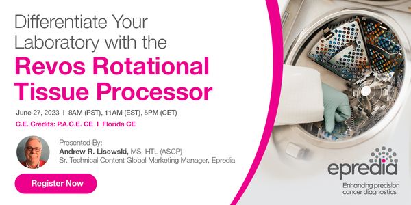 Science of Tissue Processing, Tidal vs. Rotational processing